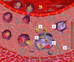 Atherosclerose